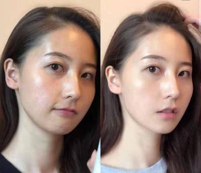 强2024解析祛斑10强名单凯时尊龙淡斑精华液排行榜10(图9)